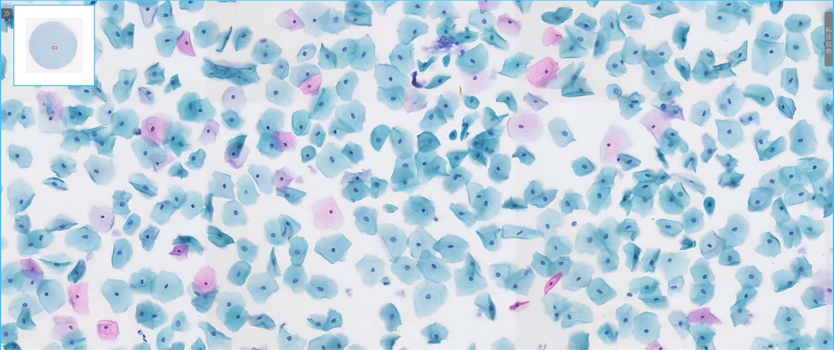 Pap-stained slide preparation result 1