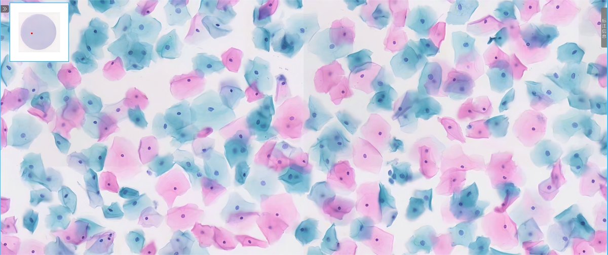 Pap-stained slide preparation result 3
